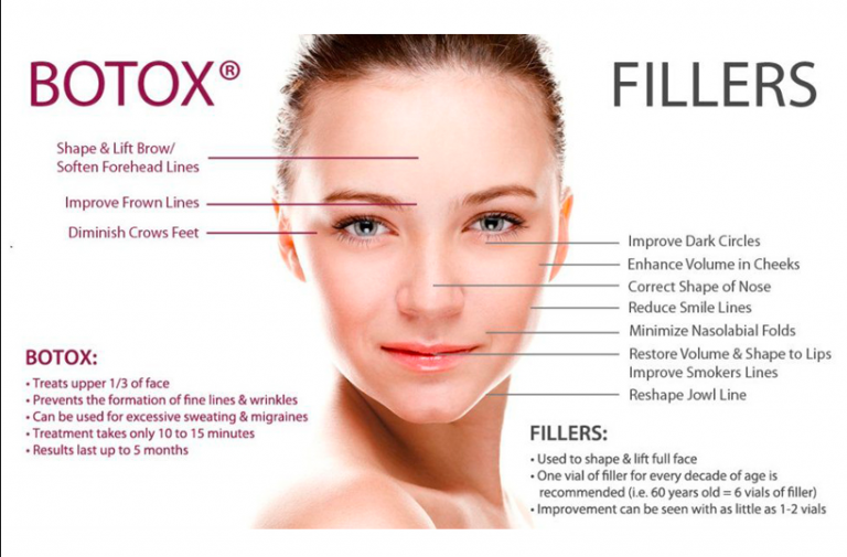How To Make Your Botox And Dermal Filler Last Longer? Check Out The 4